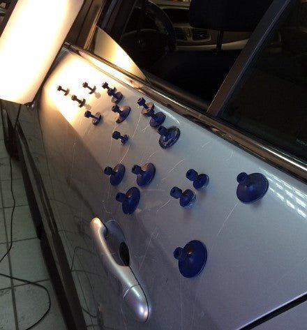 Boyasız Göçük Düzeltme Nedir ? (Pdr) - DoctorPdrTools